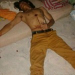 Ys(27) Korban Percobaan Bunuh diri Terkapar bersimbah darah dirumahnya Karena Depresi